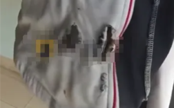 刚买一个月的充电宝突然自燃 17岁高中生校服被烧出大洞 !