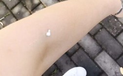 女人左手上鸟屎的预兆（揭示女人左手上鸟屎的预示意义） ！