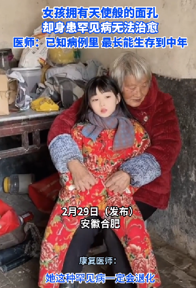 女孩拥有天使般面孔却身患不治之症 网友：落入凡间的天使 ！-图1