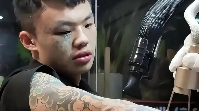 “纹面男孩”称再洗2次纹身就干净了：莫让一时的冲动成为终身的遗憾 ！-图1