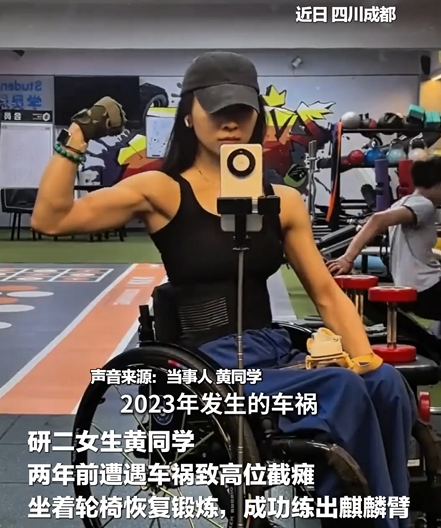 24岁女生高位截瘫后 轮椅上练出麒麟臂 最多能高位下拉80公斤 !-图1
